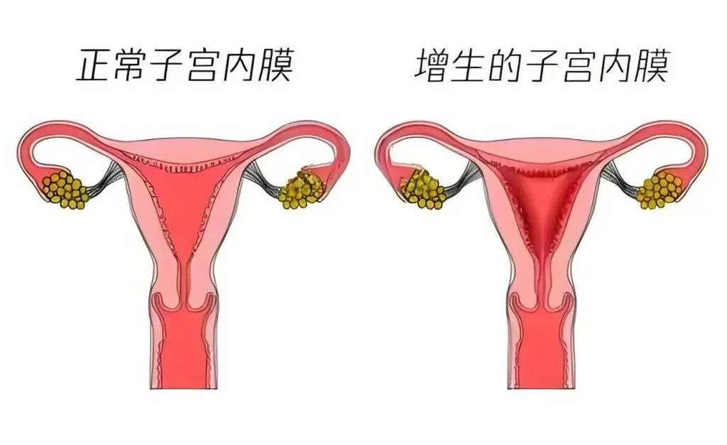 内膜形态是长什么样的_2