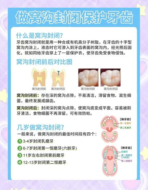 5岁娃龋齿怎么办-5 岁龋齿怎么办。
