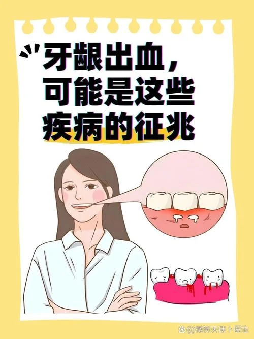 牙龈出血每天都出自发_1