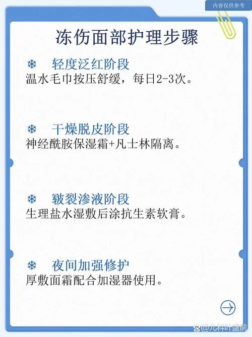 冬天脸被冻伤了怎么办-冬天冻伤脸怎么办