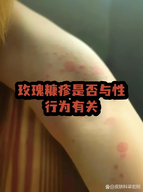 什么是自限性疾病自愈_1