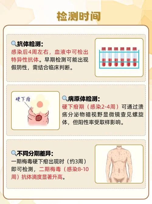 梅毒如何查的出来-梅毒检测方法