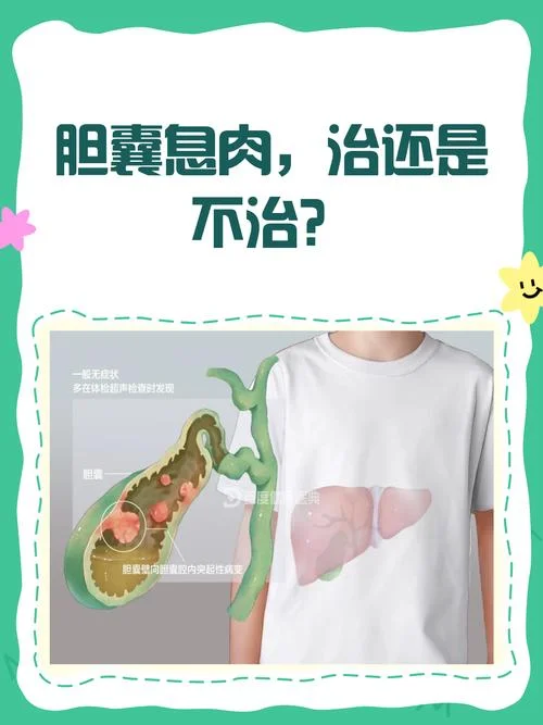 有胆息肉怎么办-有胆息肉怎么办