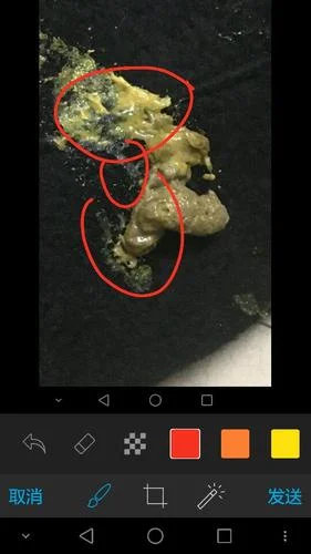 梦见嘴里吐出虫子_2