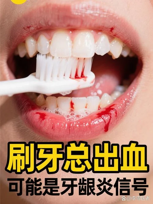 做梦掉了一颗牙齿出血-梦掉牙出血