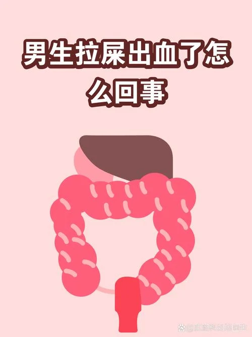想吐便鲜血是为什么_1