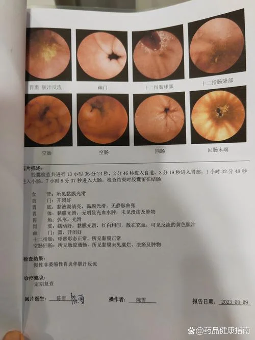 检查胃镜是查什么的_2