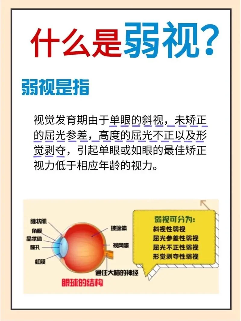 近视眼可以学开车吗-近视能否学开车