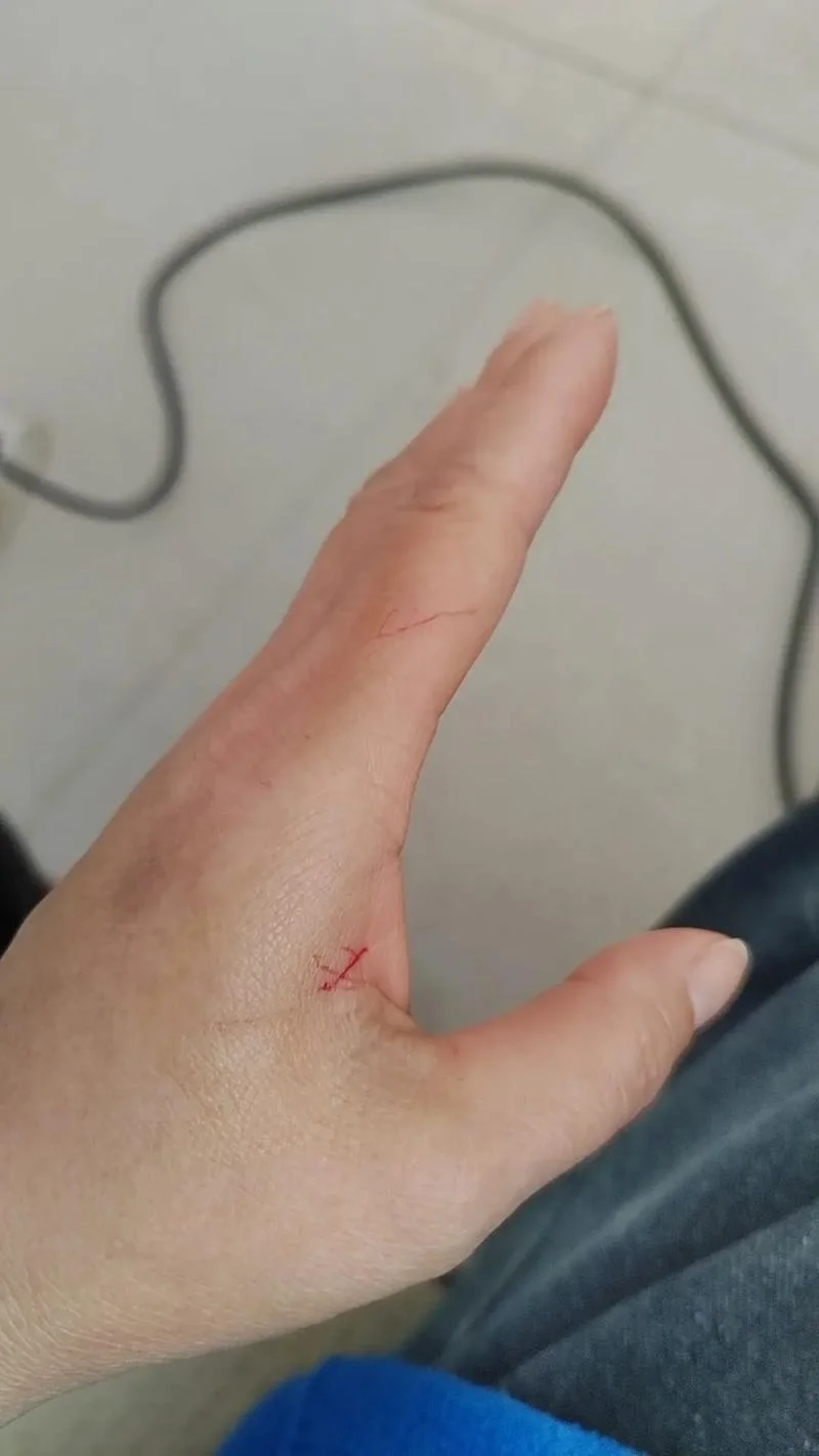 梦见被猫抓伤还出血了-梦见被猫抓伤流血