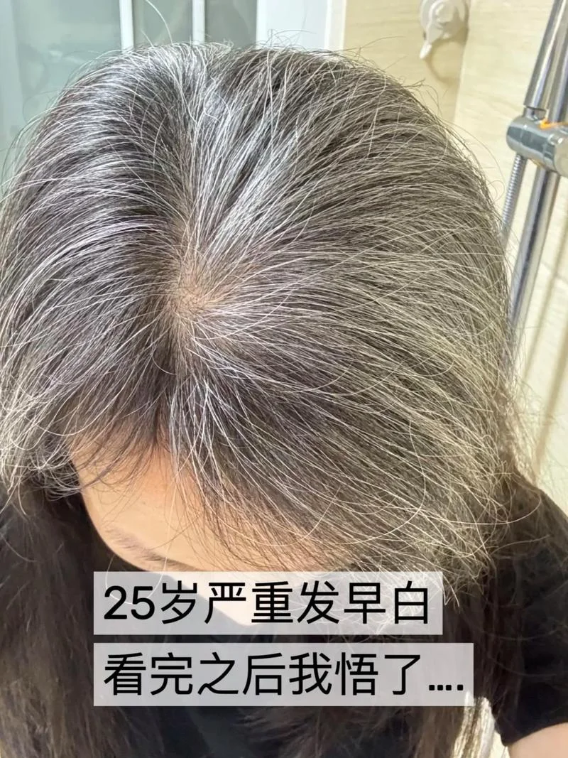 梦见老爸头发变白了-梦见父亲白头