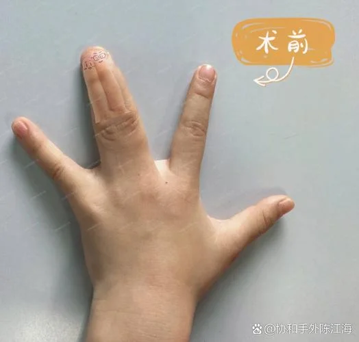 第四个手指叫什么指_1