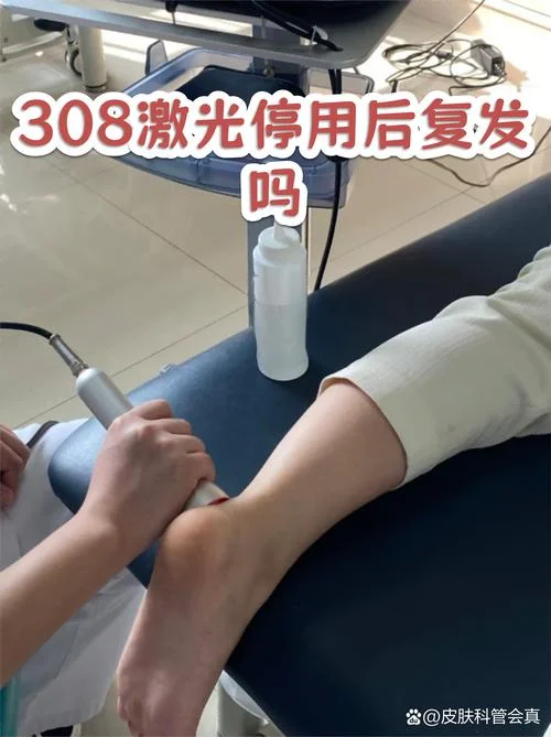 308光疗多少钱一个平方_1