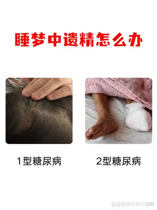 什么是遗精_1