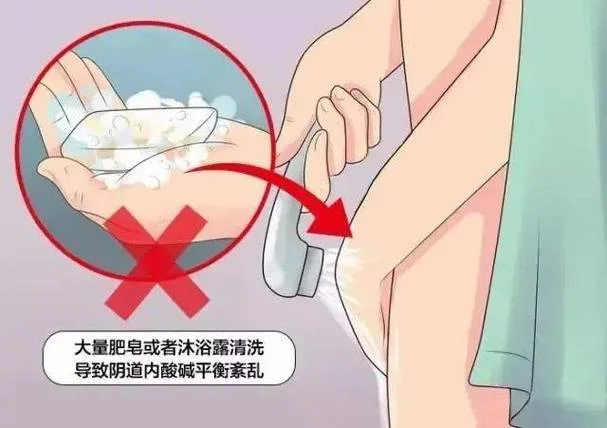阴道瘙痒厉害怎么办_2