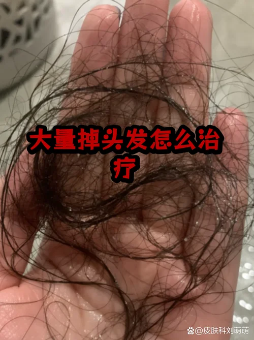 心烦脱发的说说_1