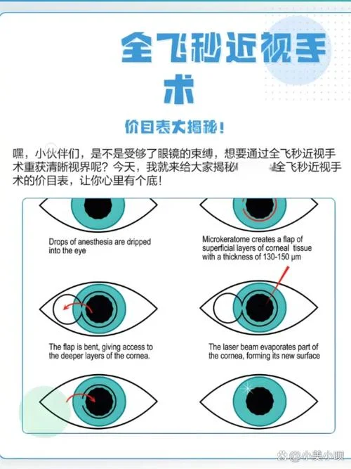近视眼做全飞秒多少钱-近视眼全飞秒费用