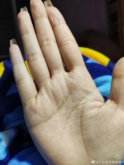 手相密密麻麻的细纹-手相细纹密密麻麻