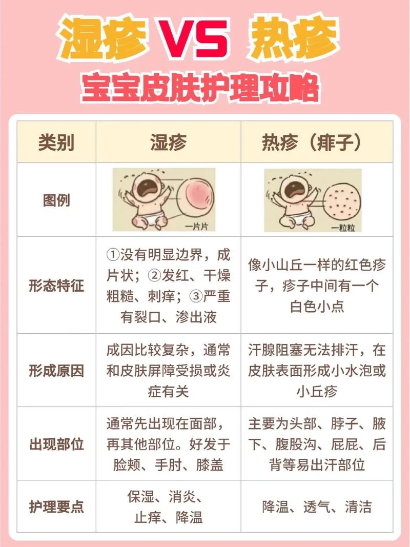 孩子热痱子怎么办_1