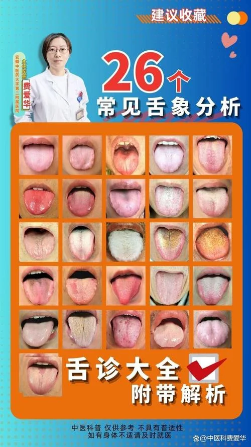 学舌诊心得体会_2