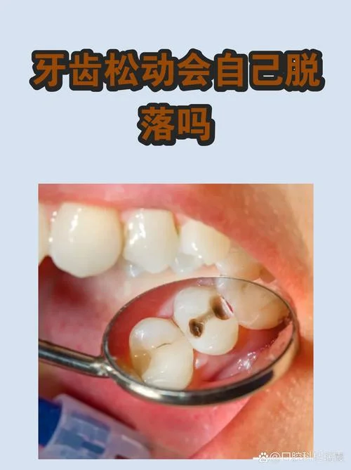 梦见牙齿脱落或松动_2