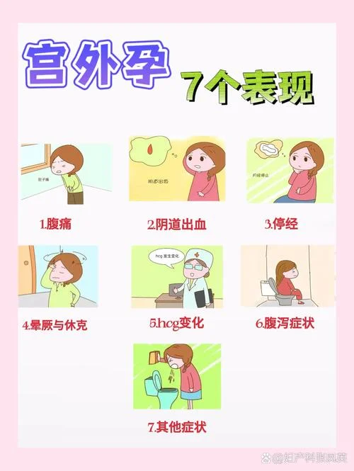 梦见宫外孕_2