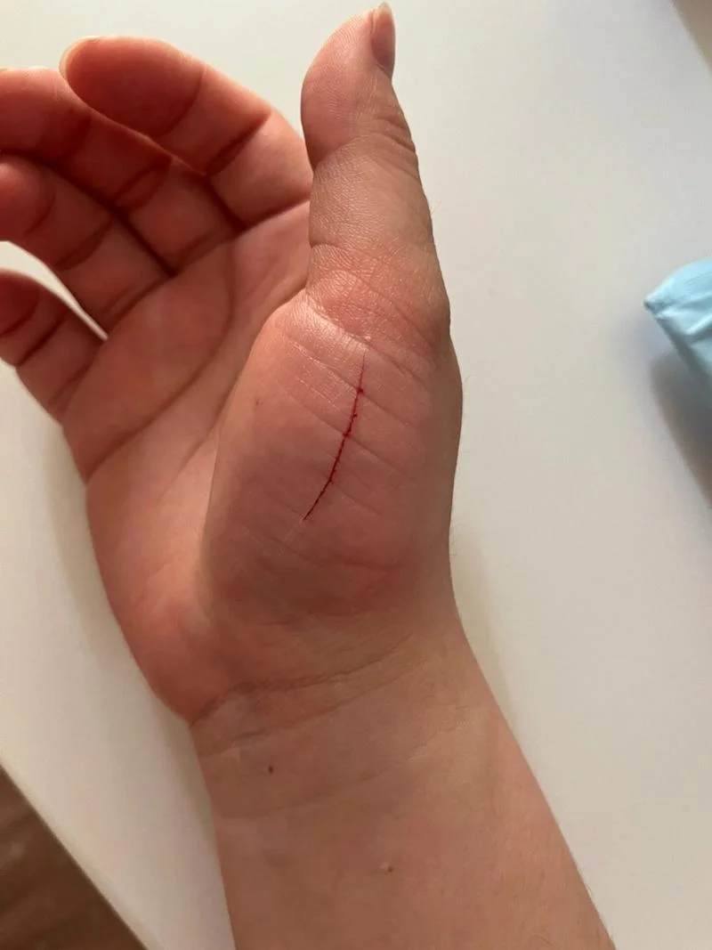 女人梦到被黑猫咬到手_2